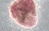 胚胎干细胞的替代方案出现：多能羊水干细胞研究成功