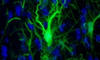 干细胞疗法新突破！植入大脑的干细胞长期存活，无需使用抗排斥药