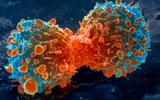 干扰肿瘤细胞铁平衡  青蒿素有望成抗癌药