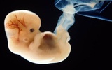 美绘制胎儿“基因蓝图”了解胎儿健康状况