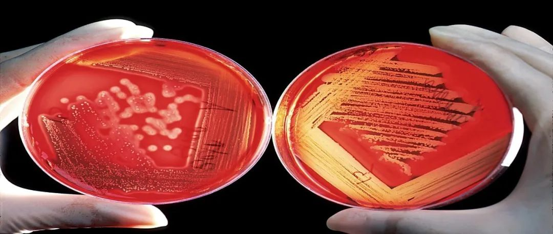 <b>破局菌种「芯片」困境，第九届微生物育种工程与应用评价研讨会即将落地无锡</b>