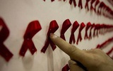 科学家研发出艾滋病自身抑制新疗法