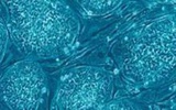 新型细胞追踪法可确定干细胞移植是否成功