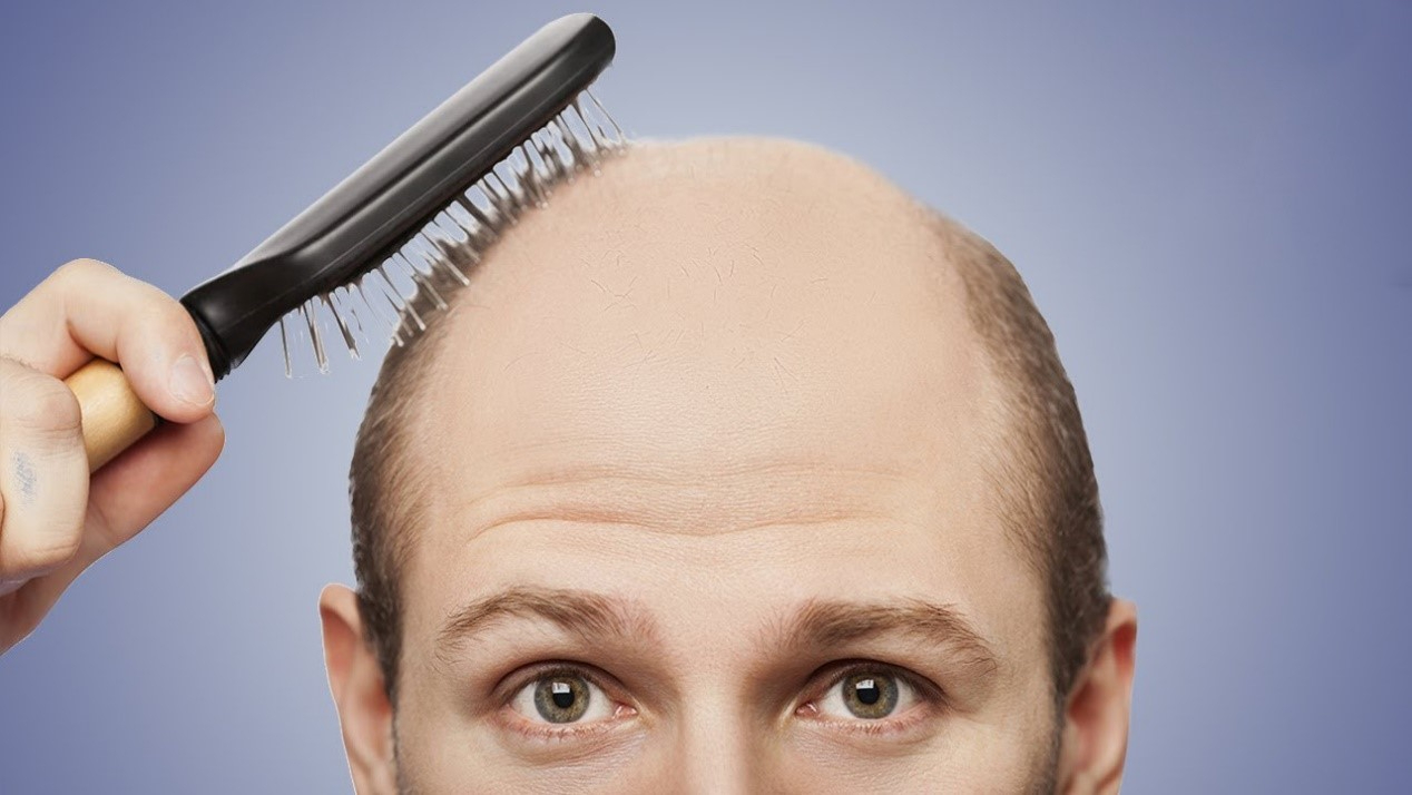 发际线有救了？新研究让毛囊再生又进一步，秃头者不再绝望