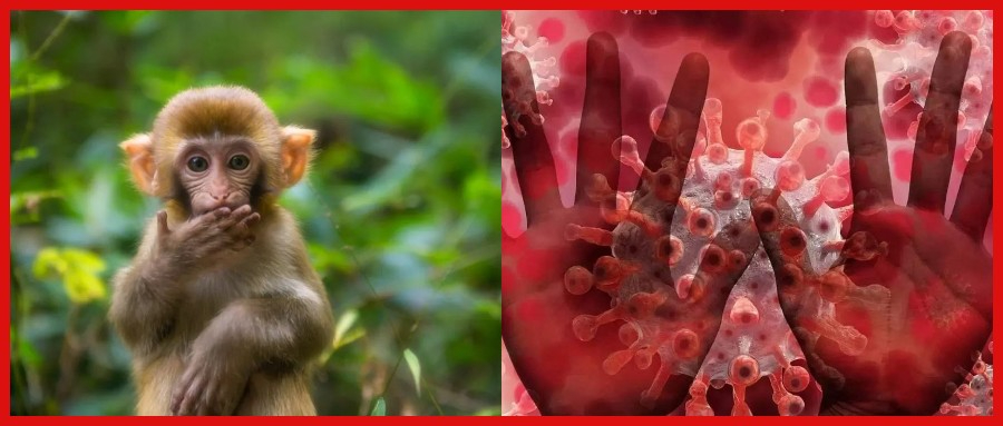 已有特效药！4国执行“猴痘隔离”，3000年前的病毒恐再次轮回？