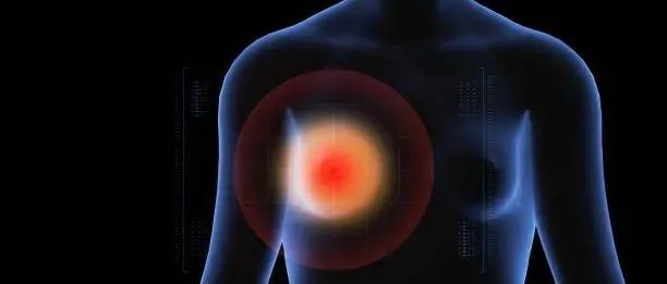 “粉红杀手”乳腺癌攻克有望？这款疫苗使乳腺癌十年生存率达80%