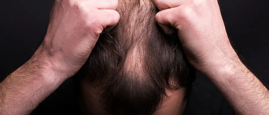 可恢复80%头发生长！辉瑞口服治疗斑秃、全秃新药上市申请纳入CDE优先审评