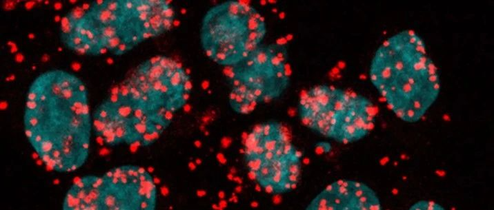 Science Advances：黏连蛋白新功能发现，影响基因的选择性剪接，突变则将导致癌
