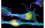 Nature子刊：细胞重编程技术加快遗传病药物筛选