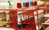 血液筛查核酸检测2015年将覆盖全国