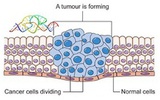卵巢癌细胞借助RNA分子“挟持”周围细胞