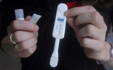 唾液诊断成艾滋病检查新贵