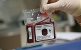世界首个脐带血制剂获美国“最佳生物技术产品奖”提名