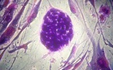 日本：利用胚胎干细胞研究渐冻症