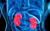 Nature Medicine：首个肾癌治疗性疫苗研制成功