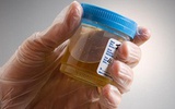 Nat. Methods：裴端卿等将尿液中细胞诱导生成神经干细胞