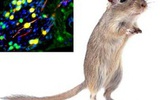 人类胚胎干细胞移植耳聋沙鼠后可恢复其听力