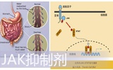 JAK抑制剂Tofacitinib可治疗溃疡性结肠炎