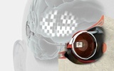 内置型仿生眼技术首次让植入者恢复部分视力