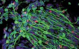 研究发现Sox2转录因子可将脐带血细胞转化为神经元样细胞