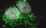 eLife：一种用于癌症免疫治疗的新型T细胞