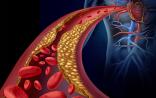 【注意你的体检单】Science显示HDL高不一定标志心血管健康