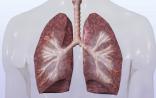 综述：小细胞肺癌的靶向治疗进展