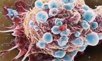 突破！科学家首次在多癌种中证实TMB可预测免疫治疗效果
