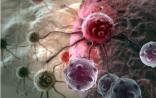 肿瘤专家揭秘：细胞治疗不是越“多”越好