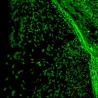 Science Daily: 生物活性的水凝胶用于治疗膝盖软骨损伤，预防骨关节炎