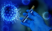 又一国产新冠试剂盒出海成功，万泰生物新冠抗原检测试剂盒通过德国BfArM批准