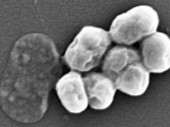 超级细菌“特种兵”！鲍