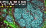 “助推”杀手T细胞，增强实体瘤的免疫治疗效果 | Science子刊