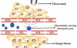 PNAS：细胞超声技术有望为基因疗法带来新发展