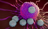 NEJM：首个报道！CAR-T让这种淋巴瘤的脑转移完全缓解