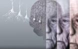阿尔茨海默症重要触发因素被发现：治愈的新希望？