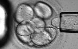 Stem Cell：Pcid2蛋白在胚胎干细胞多能性维持机制研究中取得新进展