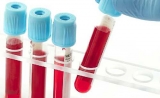 日本临床实验：通过血液查找癌症病人的变异基因