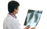 肺癌EGFR靶向治疗十年进展