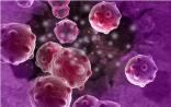 Cell：为实现精准医疗揭示系统性红斑狼疮的分子异质性
