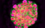 Cell Stem Cell：iPS细胞进入临床的重要一步