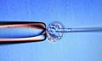 全球首例！日本出生仅6天婴儿成功获坯胎干细胞移植