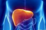 非酒精性脂肪性肝炎有望找到新疗法