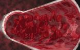 Stem Cell：新研究揭示治疗性干细胞离开血管的新机制
