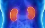 JCI insight：能透析的人工肾脏问世