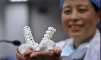 只需3天，3D打印就能“私人定制”膝关节