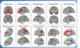 中科院绘制246个精细亚区的全新人类脑图谱  为下一代诊疗技术奠定基础