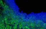 Stem Cells：用毒素分泌干细胞来治疗脑瘤