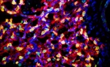 Nature Methods：一种特殊的“多功能干细胞”，有望修复肺损伤