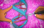 Nature子刊：新开发的基因治疗能防止癌症恶化